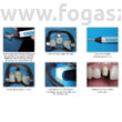 Kép 2/2 - Denticore protocol