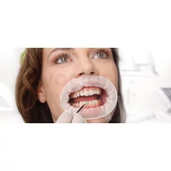 Optragate regular